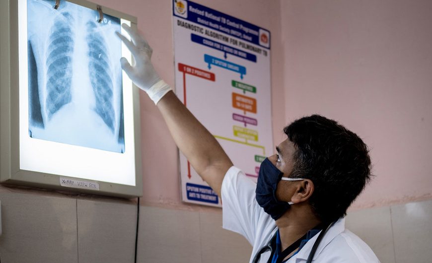Смертность от туберкулеза возросла впервые за 10 лет. Причина — пандемия COVID-19